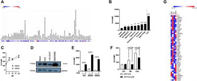 Nephrotoxicity of Calcineurin Inhibitors in Kidney Epithelial Cells is Independent of NFAT Signaling